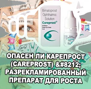 Карепрост это